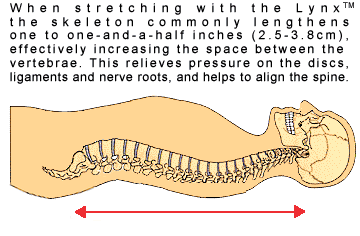 Lynx  Back Stretcher